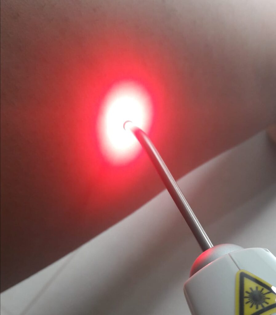 Serviço de Laserterapia na NH Vacinas